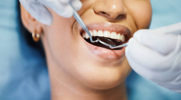 Best Chipped Tooth Repair Near Me  in Eastport, ME